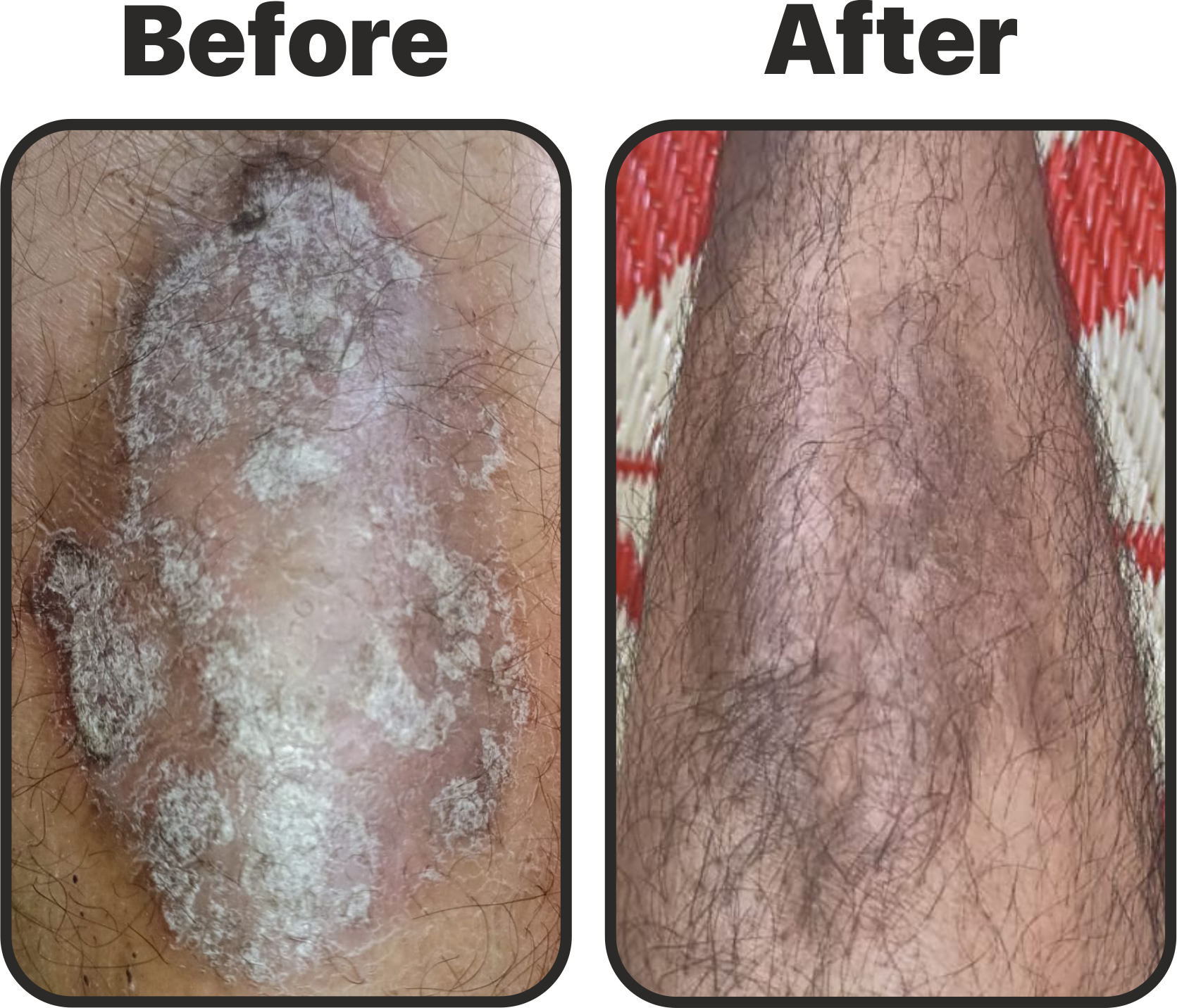 Before and after skin condition images showing improvement after following SSKNDS Natural Diet System